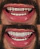 Slider image (10) Best Dental Clinic in Istanbul - Niva Aesthetic